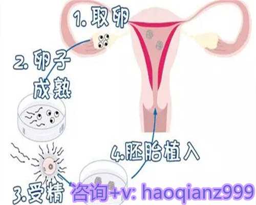 宫腔镜手术后备孕时间与提升机会的全面指南